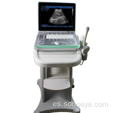 Escáner de ultrasonido de la carretilla digital